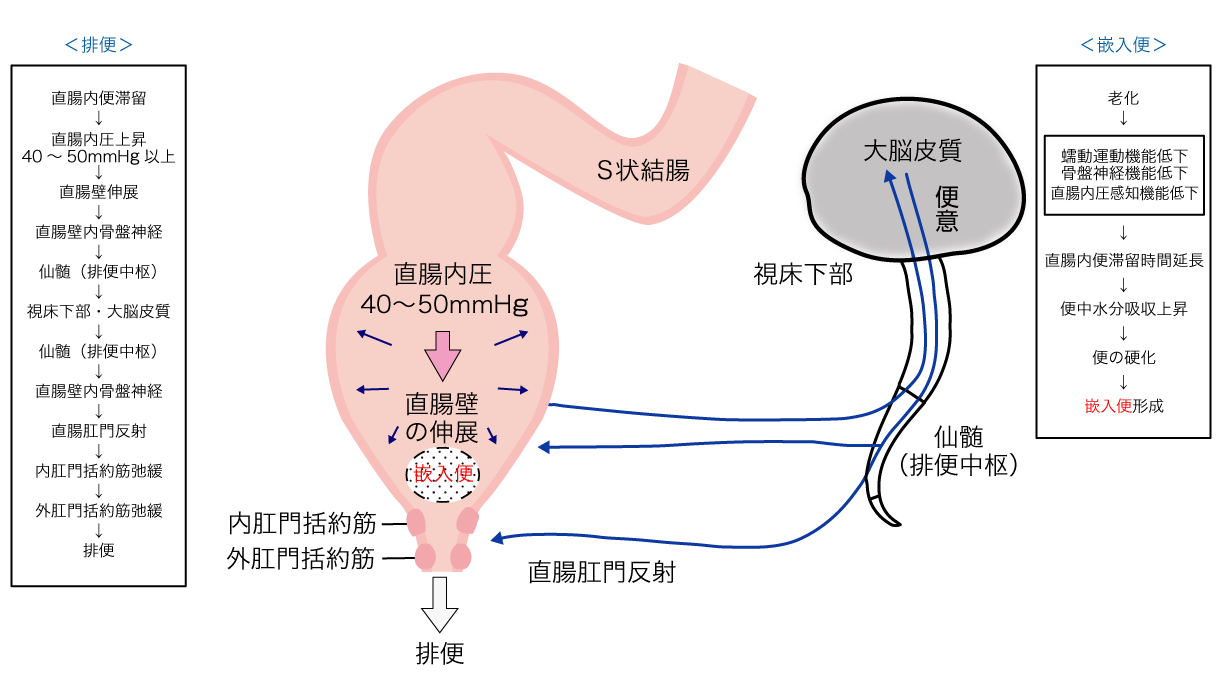 排便と嵌入便発生のメカニズム