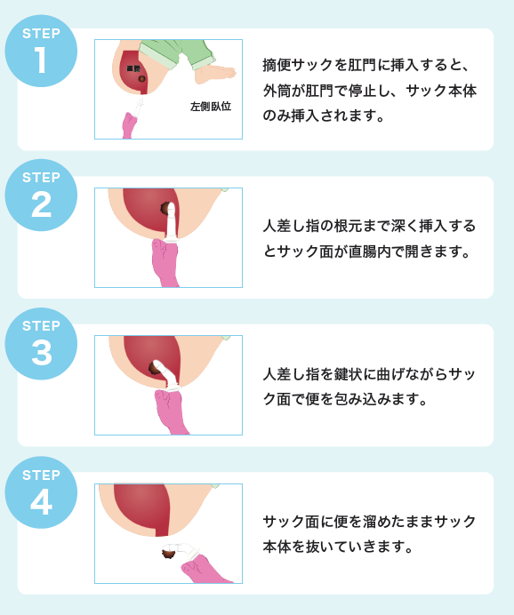 使用方法